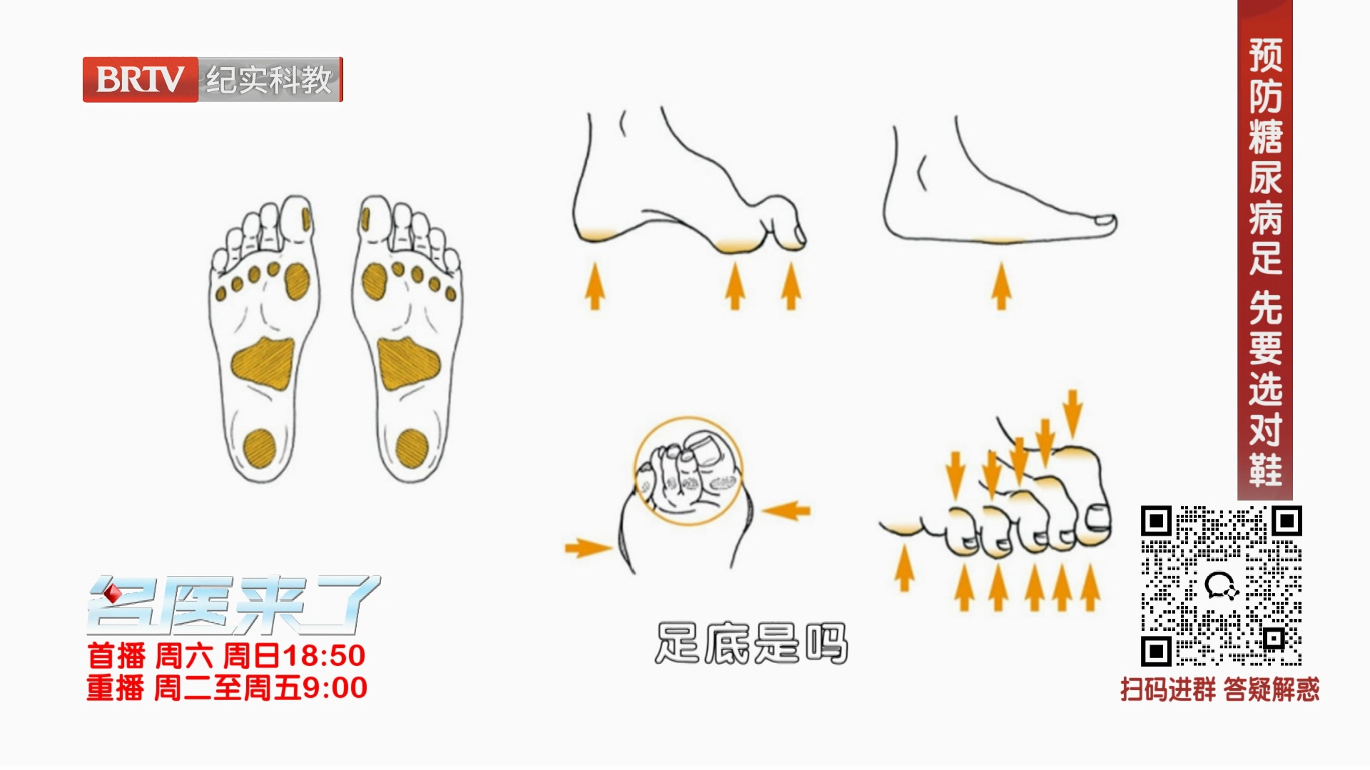 《名医来了》20260829被甜蜜摧毁的双足