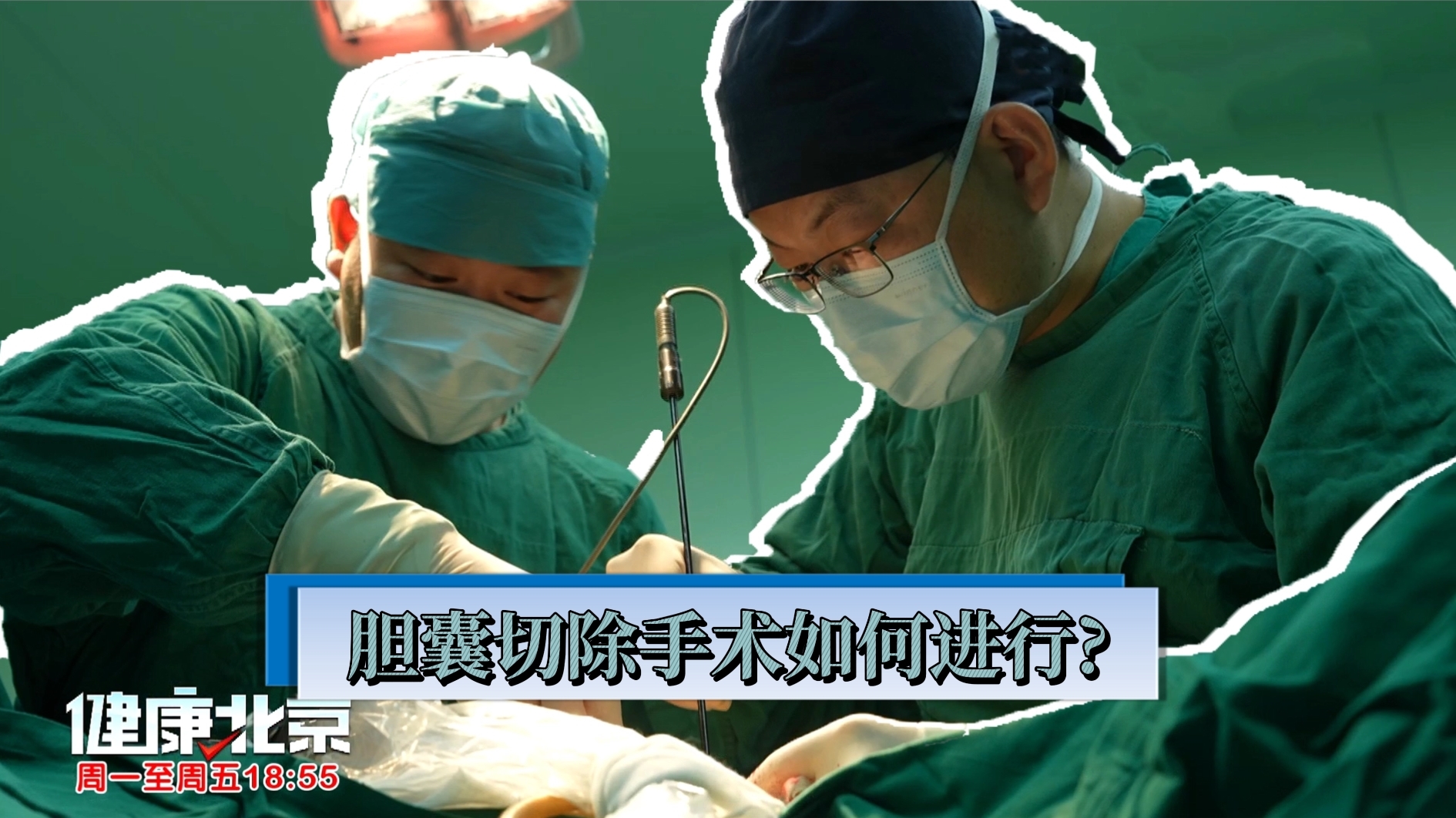 胆囊切除手术如何进行？