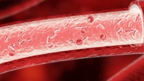 起床后有这1个表现,当心血管堵到危险线!别误以为是没睡够 起床后有这1个表现,当心血管堵到危险线!别误以为是没睡够