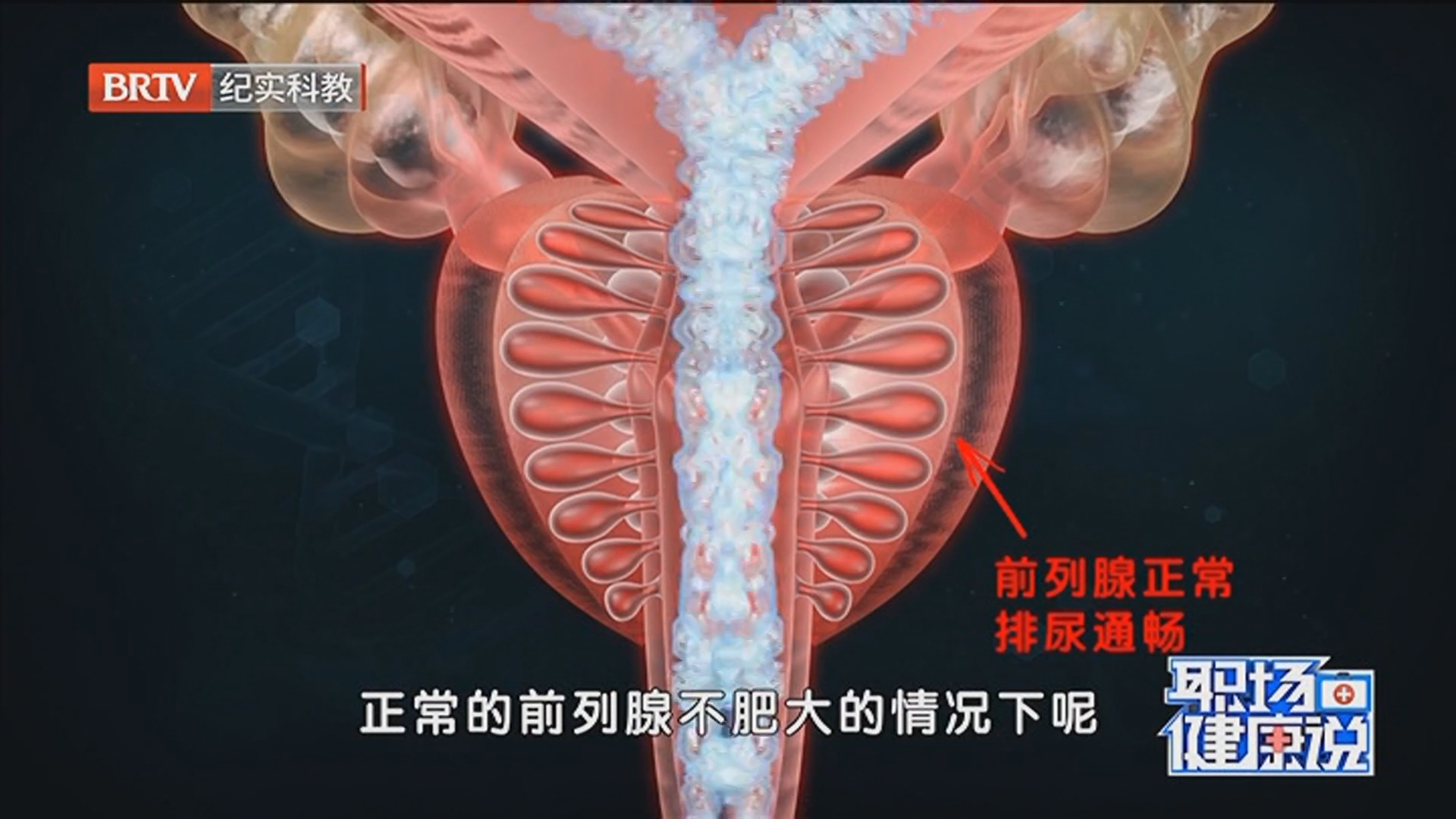 《职场健康说》20260507前列腺增生危害大 导致尿频 尿急 尿等待 尿不尽