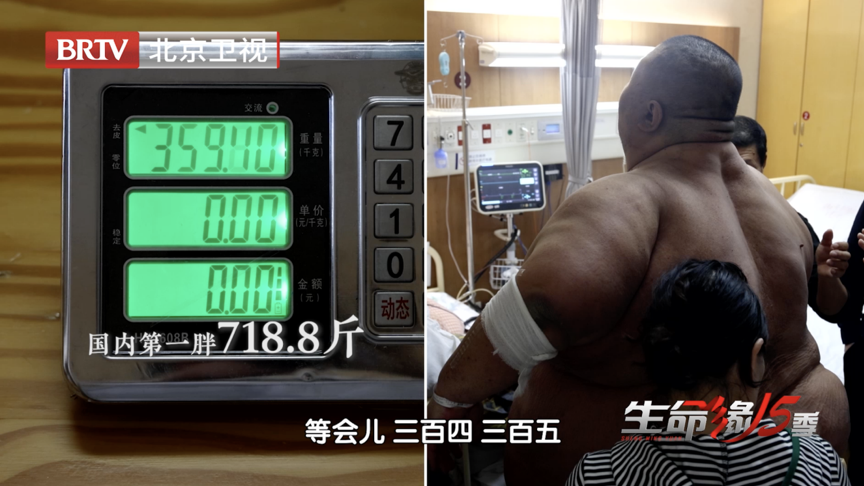 718.8斤刷新中国肥胖体重纪录 718.8斤刷新中国肥胖体重纪录