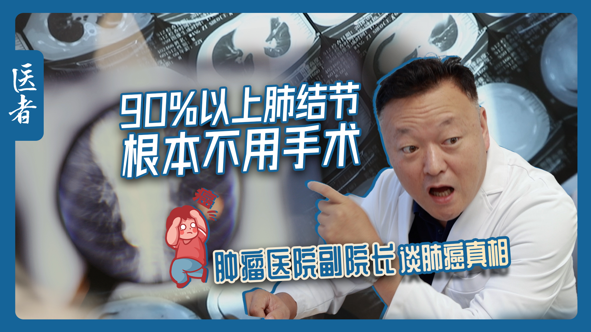 医者｜90%以上肺结节根本不用手术 肿瘤医院副院长谈肺癌真相