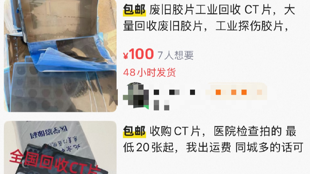 废旧CT片回收能炼银？紧急提醒：污染环境还涉嫌违法