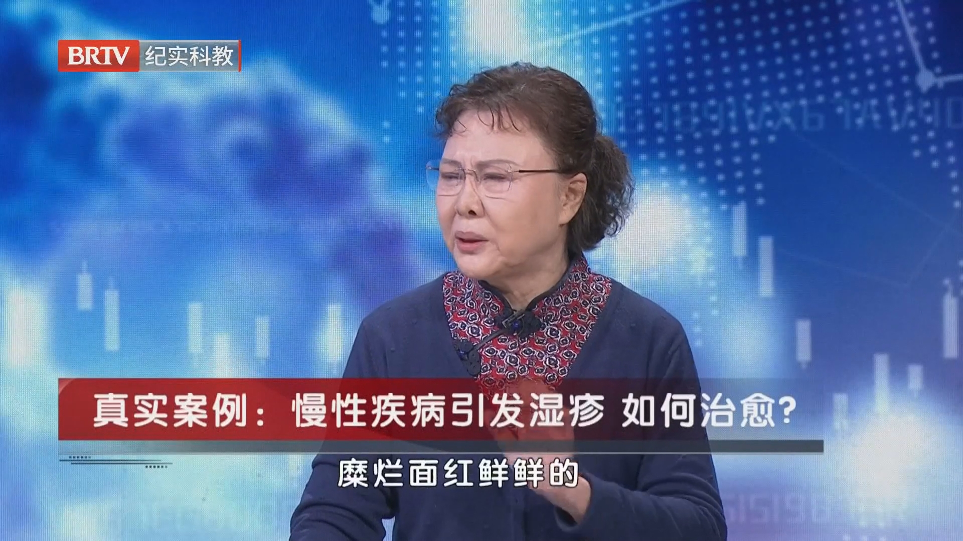 《职场健康说》20261022湿疹莫轻视 小病暗藏大隐患
