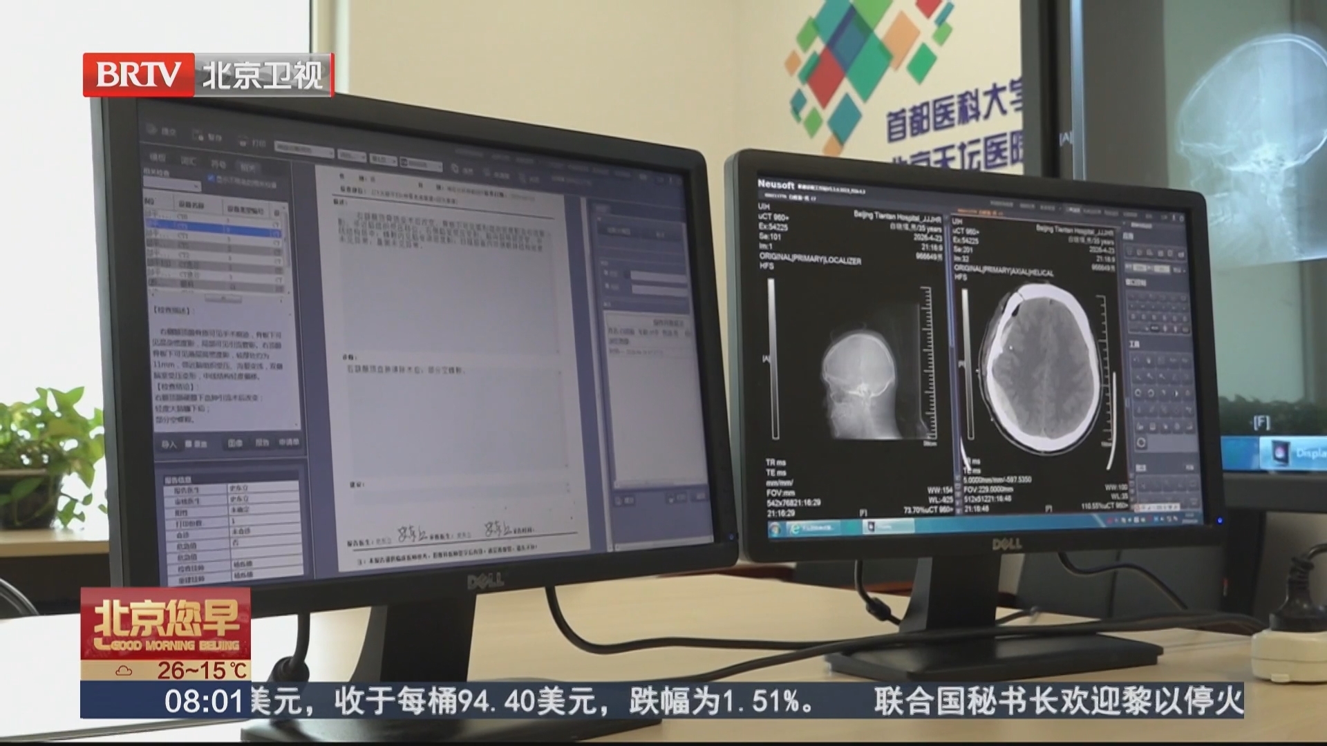 “小君医生2.0”上线 1分钟内识别颅脑相关94种疾病