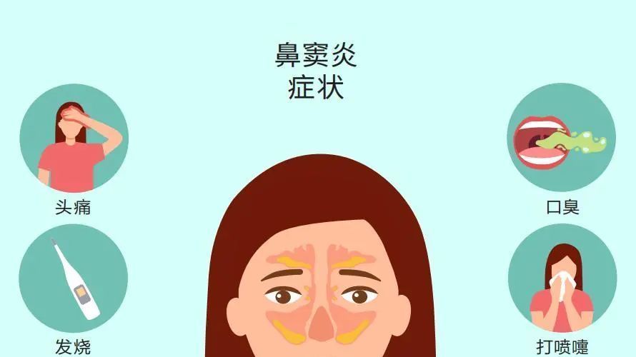 鼻塞、头痛、口臭……鼻窦炎反复折磨，真凶首次被找到！