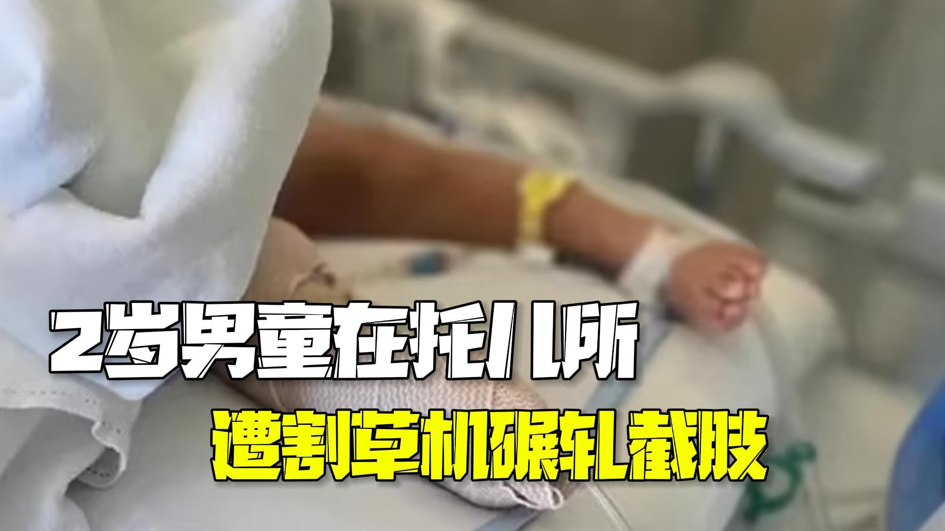 2岁男童托儿所草坪玩耍 遭割草机碾轧截去右脚 2岁男童托儿所草坪玩耍 遭割草机碾轧截去右脚