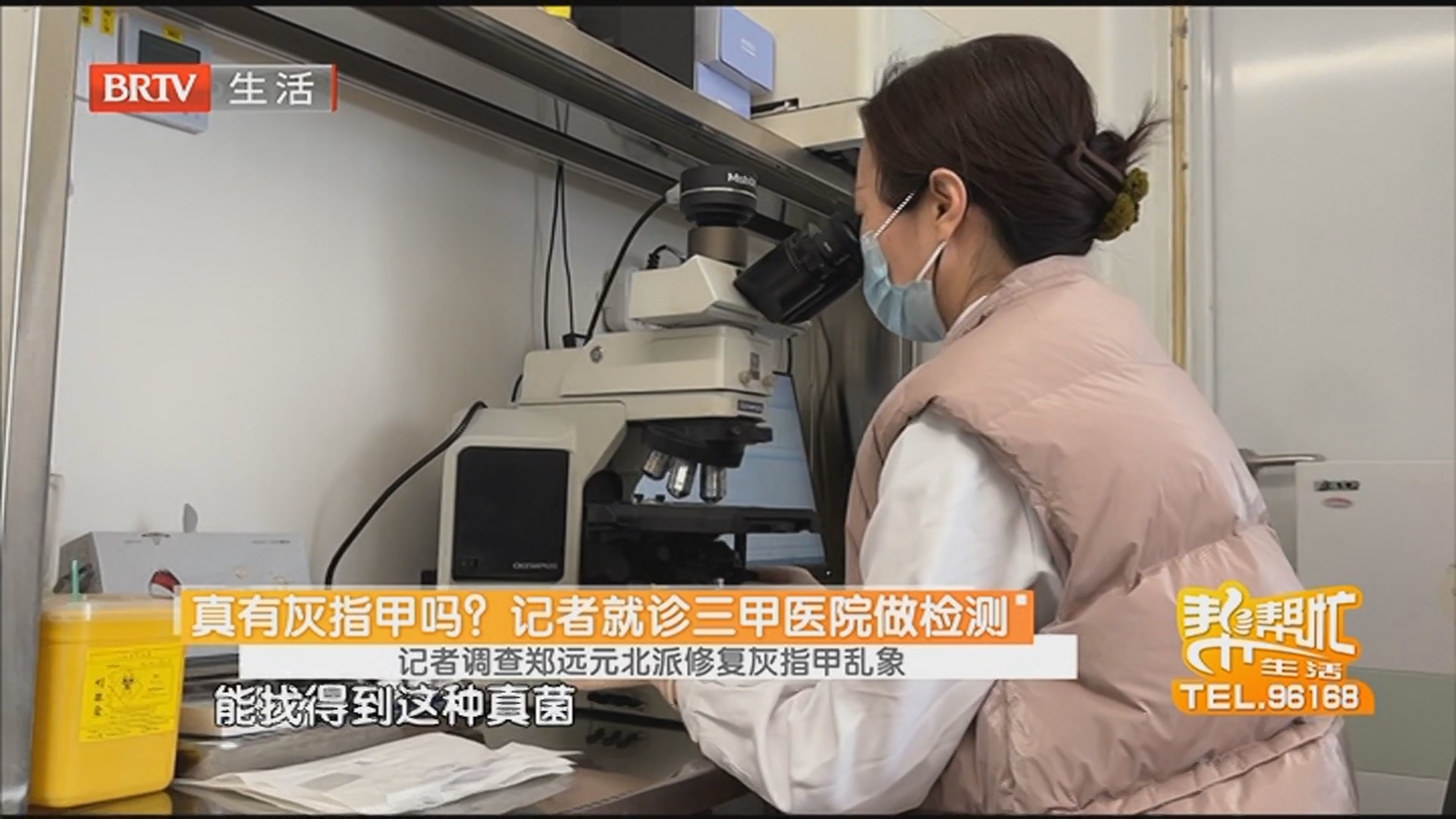 记者就诊三甲医院做检测 记者调查郑远元北派修复灰指甲乱象