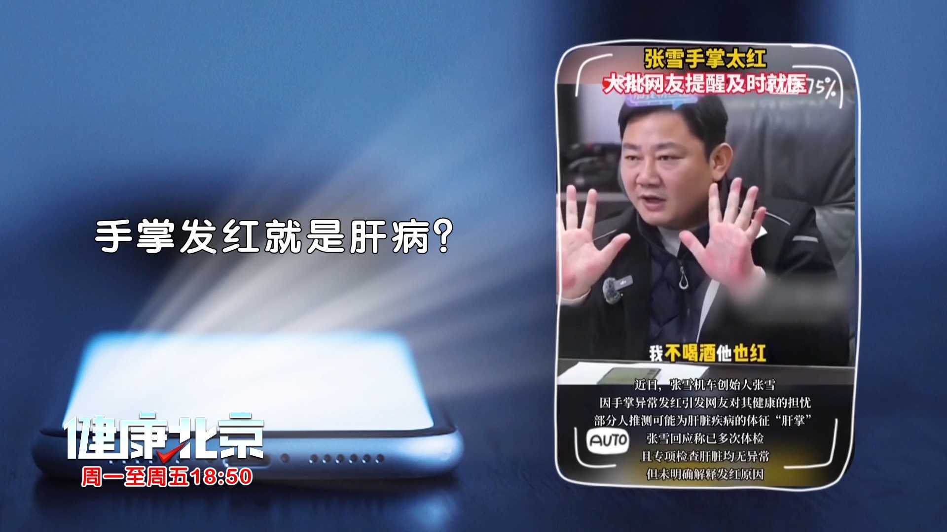 “鹅肝掌” 是肝在报警吗? “鹅肝掌” 是肝在报警吗?