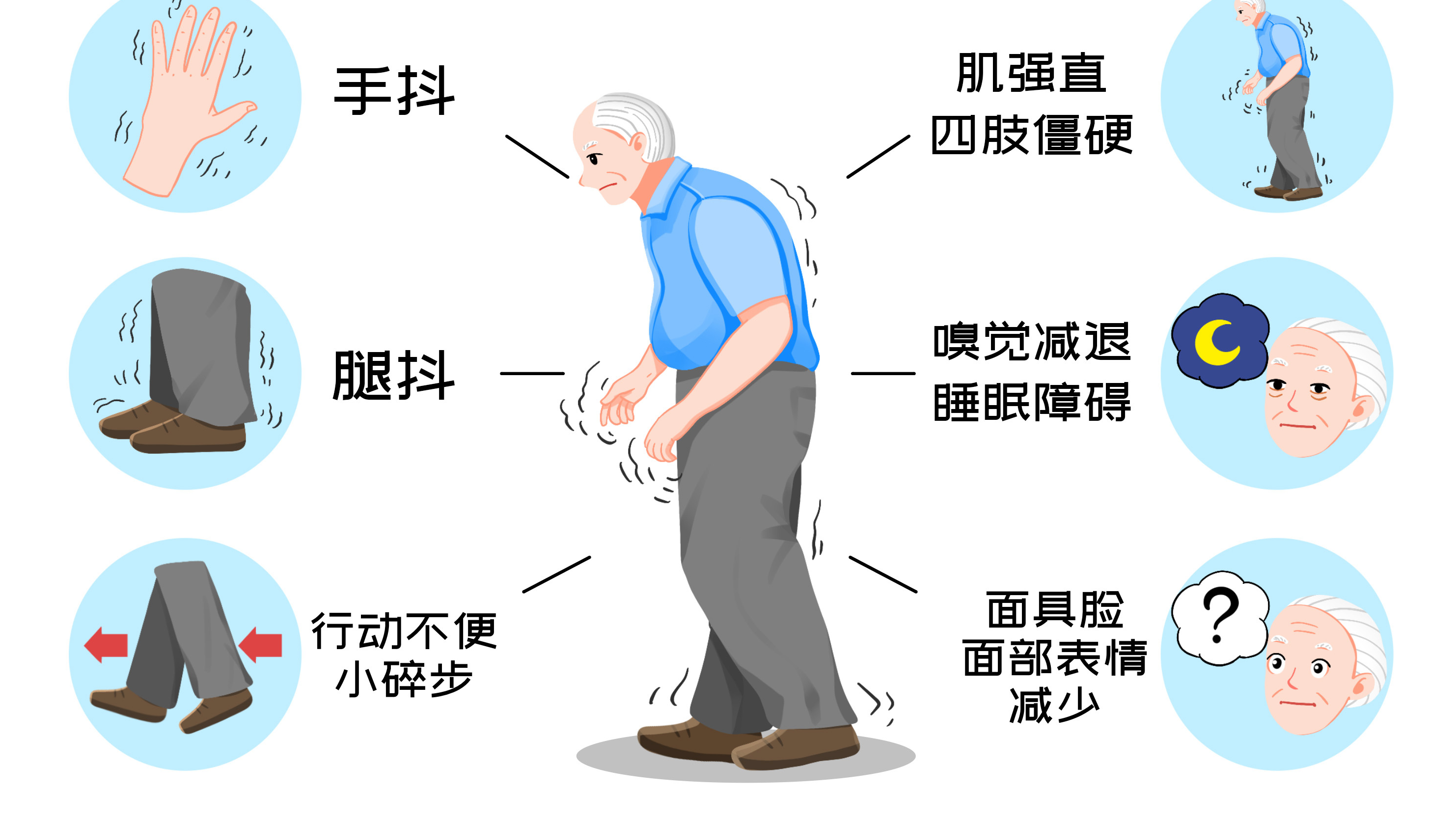 帕金森病：不止震颤，非运动症状早知晓！