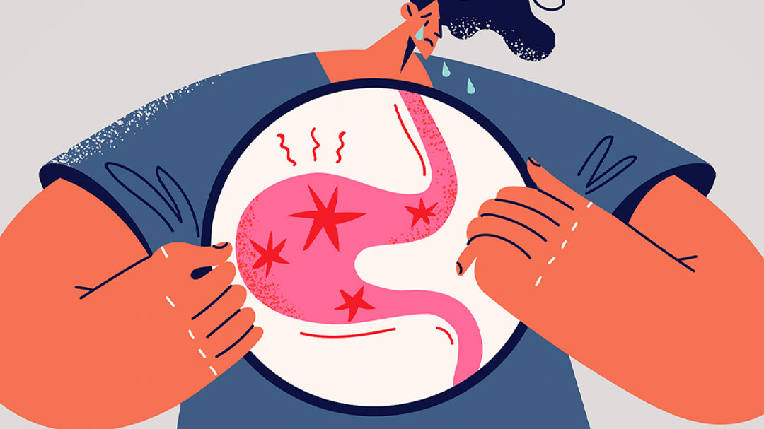 一图读懂|“胃萎缩”是怎么回事?会导致癌变吗? 一图读懂|“胃萎缩”是怎么回事?会导致癌变吗?