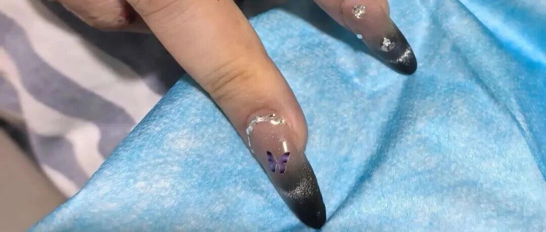 抢救室里，“医生请来美甲师‘救命’”引热议