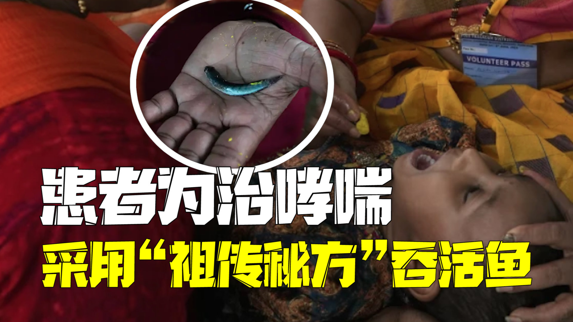 印度成千上万患者为治哮喘 采用“祖传秘方”吞活鱼