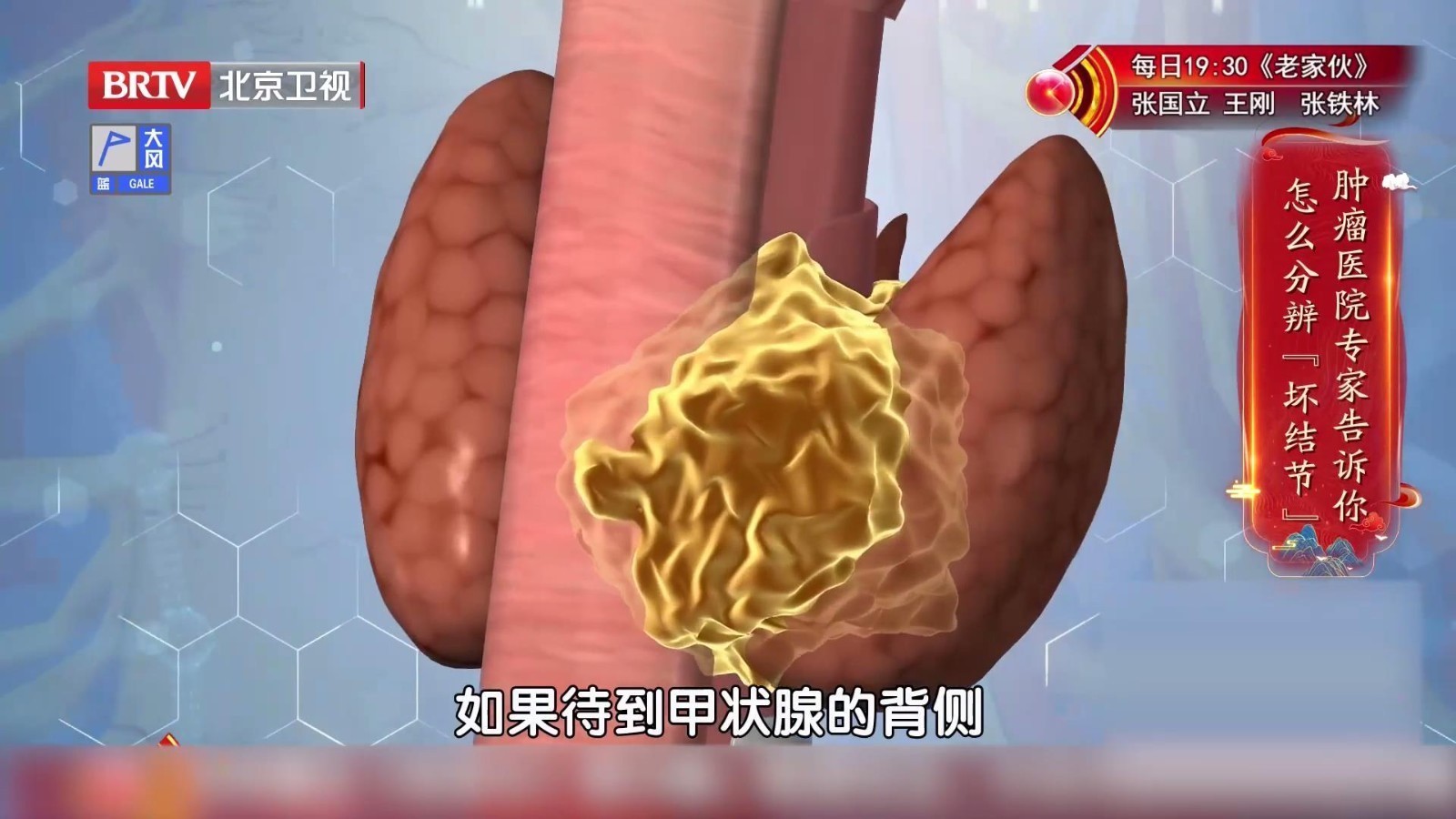 结节的大小、位置，不能完全决定对性质的判断，定期复查最重要