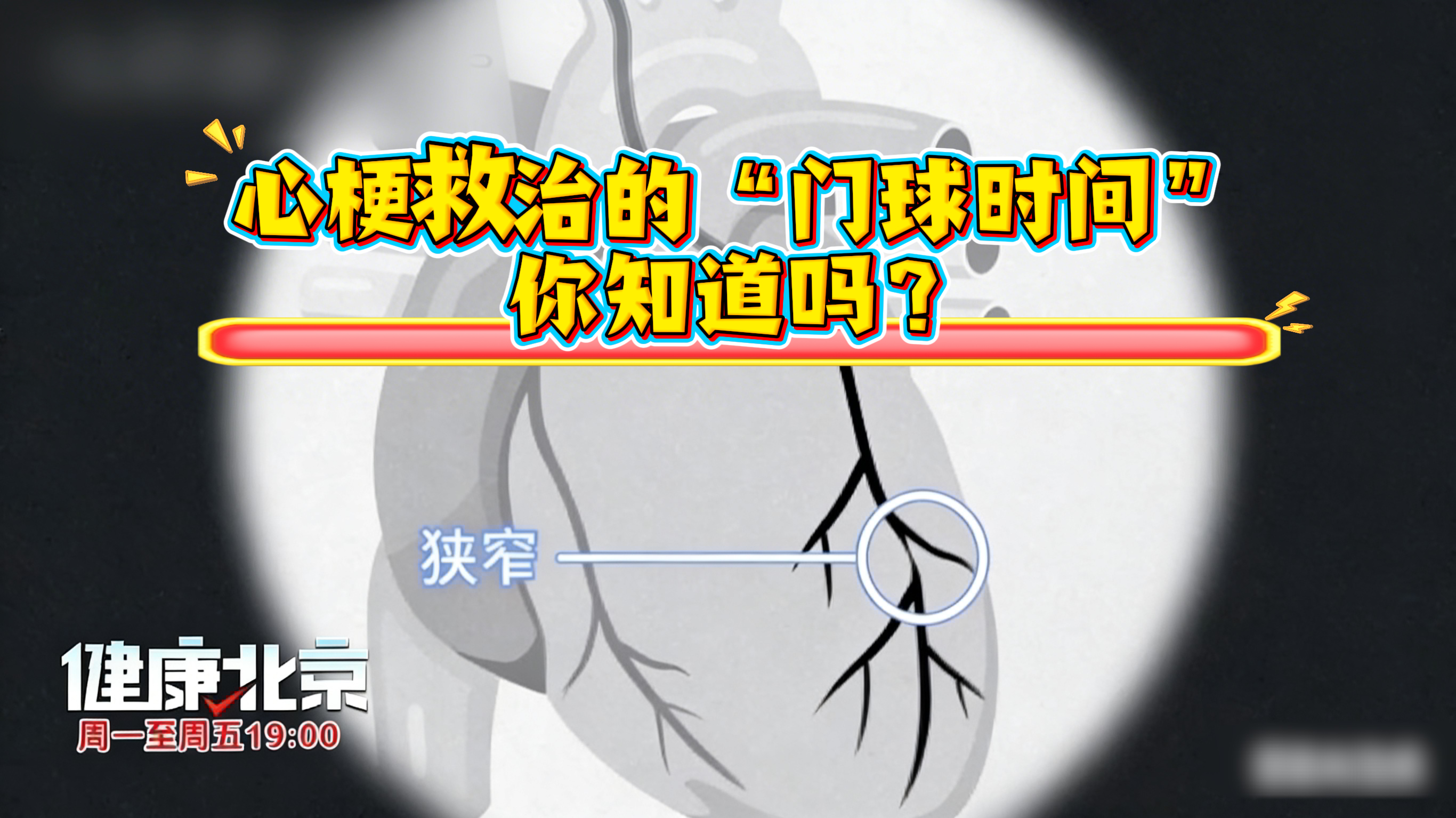 心梗救治的“门球时间”,你知道吗? 心梗救治的“门球时间”,你知道吗?