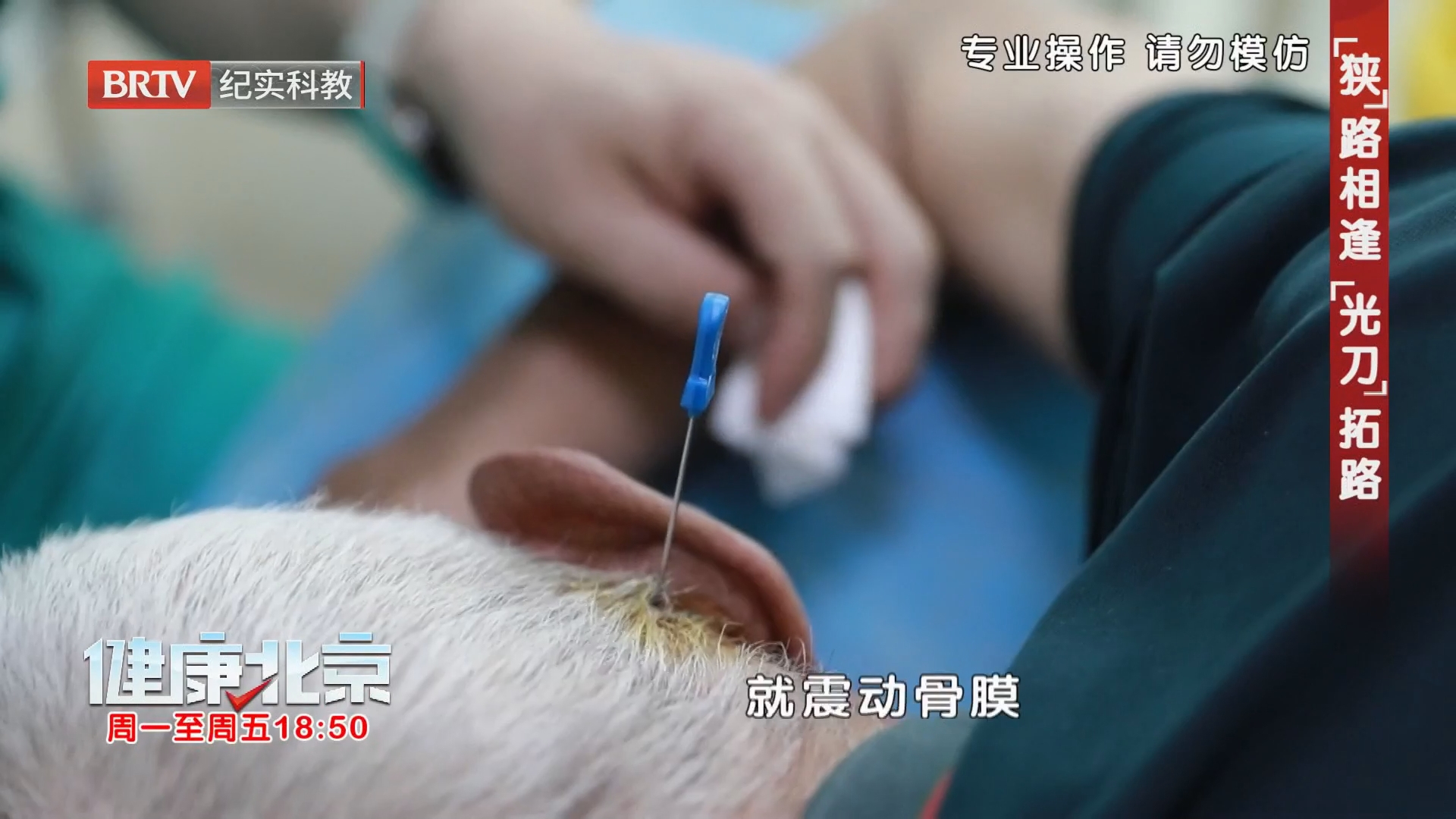 激光可直达病灶 消炎止痛（上）